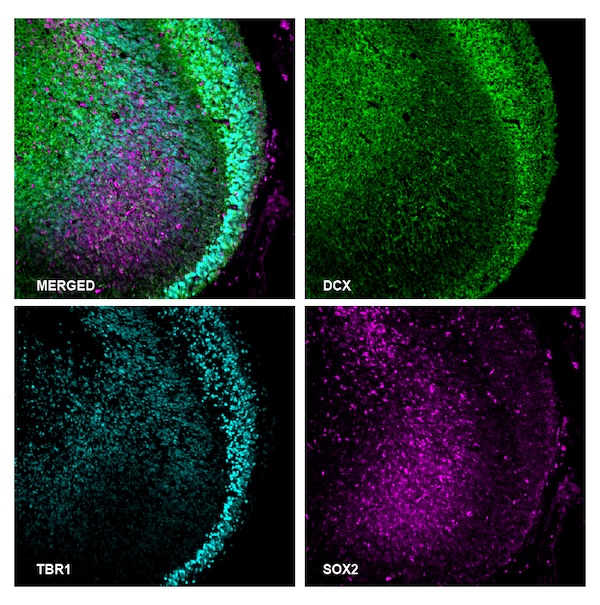 2.	mIHC neurodevelopmental Cell-Type Profiling of mouse embryo brain (E14) using AtlasPlex