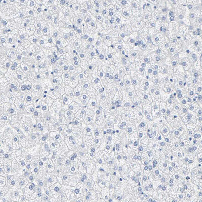 Anti-ACPP Human Protein Atlas Antibody