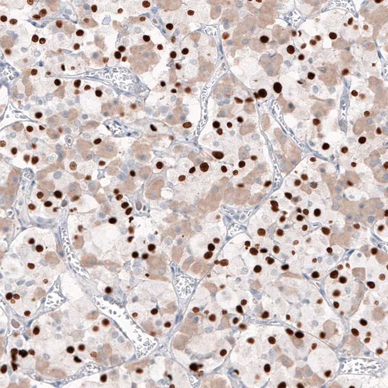 AMAb91409-ihc-2.jpg AMAb91409-ihc-2.jpg