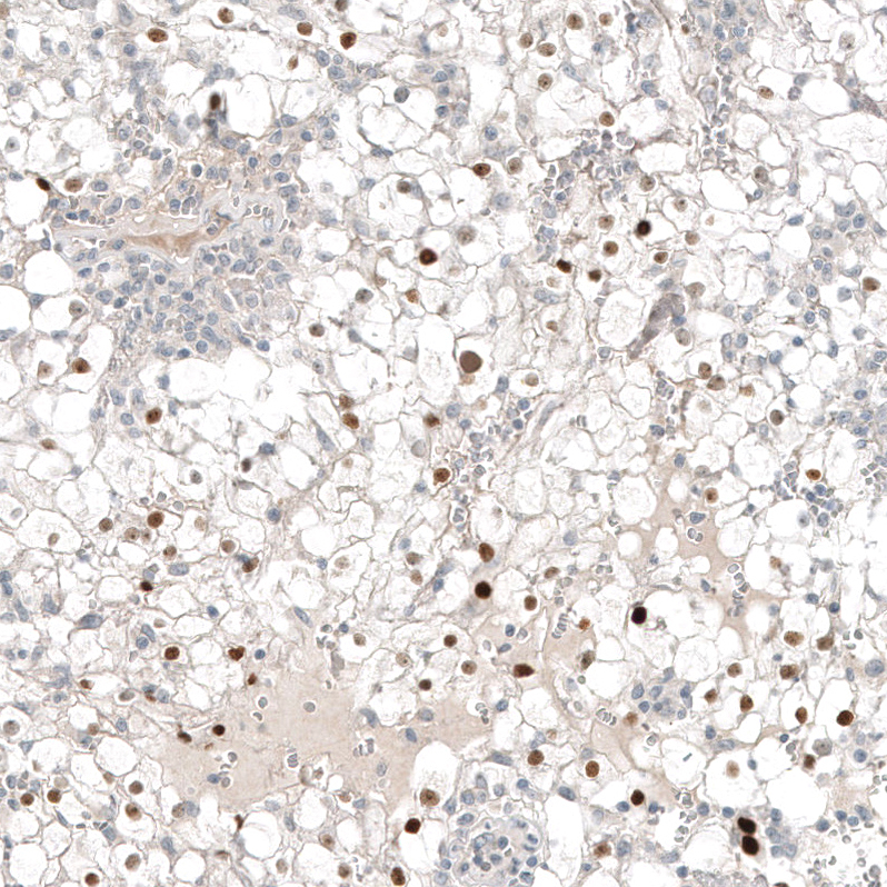 Anti-PAX8 Antibody