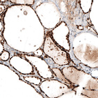 Immunohistochemical staining of human thyroid gland shows strong nuclear positivity in glandular cells.