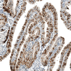Immunohistochemical staining of human Fallopian tube shows moderate to strong nuclear positivity in glandular cells.
