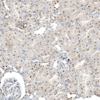Immunohistochemical staining of human kidney shows weak to moderate nuclear positivity in cells in tubules.