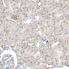 Immunohistochemical staining of human kidney shows weak to moderate nuclear positivity in cells in tubules.