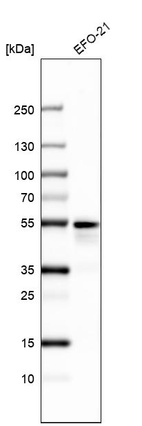 Western blot analysis in human cell line EFO-21.