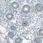 Immunohistochemical staining of human endometrium shows moderate positivity in apical membrane in glandular cells.