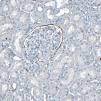 Immunohistochemical staining of human kidney shows moderate positivity in Bowman's capsule.