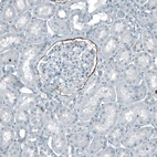 Immunohistochemical staining of human kidney shows moderate positivity in Bowman's capsule.