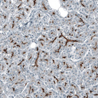 Immunohistochemical staining of human pancreas shows strong membranous positivity in intercalated ducts.