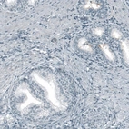 Immunohistochemical staining of human prostate shows no positivity in glandular cells as expected.