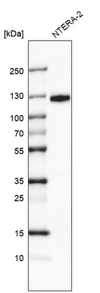 Western blot analysis in human cell line NTERA-2.