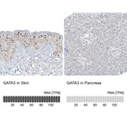 Anti-GATA3 Antibody