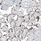 Anti-GATA3 Antibody