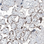 Immunohistochemical staining of human placenta shows moderate to strong nuclear positivity in trophoblastic cells.