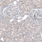 Immunohistochemical staining of human kidney shows strong nuclear positivity in a small subset of cells in glomeruli.