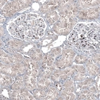 Immunohistochemical staining of human kidney shows strong nuclear positivity in a small subset of cells in glomeruli.