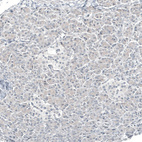 Immunohistochemical staining of human pancreas shows no positivity in exocrine glandular cells as expected.