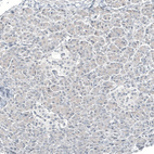 Anti-GATA3 Antibody