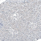 Immunohistochemical staining of human pancreas shows no positivity in exocrine glandular cells as expected.