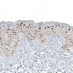 Immunohistochemical staining of human skin shows moderate to strong nuclear positivity in squamous epithelial cells.
