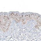 Immunohistochemical staining of human skin shows moderate to strong nuclear positivity in squamous epithelial cells.