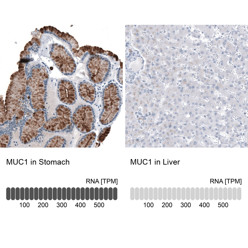 Mouse Monoclonal Anti-MUC1 Antibody - Buy for research - Highly ...