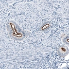 Immunohistochemical staining of human endometrium shows strong positivity in apical membrane in glandular cells.