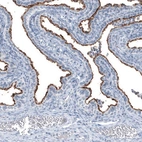 Immunohistochemical staining of human Fallopian tube shows strong positivity in apical membrane in glandular cells.
