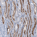 Anti-MUC1 Antibody