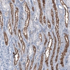 Immunohistochemical staining of human kidney shows strong membranous positivity in cells in tubules.