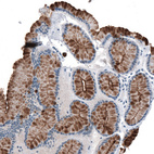 Anti-MUC1 Antibody