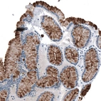 Immunohistochemical staining of human stomach shows strong cytoplasmic and membranous positivity in glandular cells.