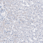 Immunohistochemical staining of human liver shows low positivity in hepatocytes as expected.