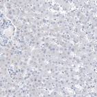 Immunohistochemical staining of human liver shows low positivity in hepatocytes as expected.
