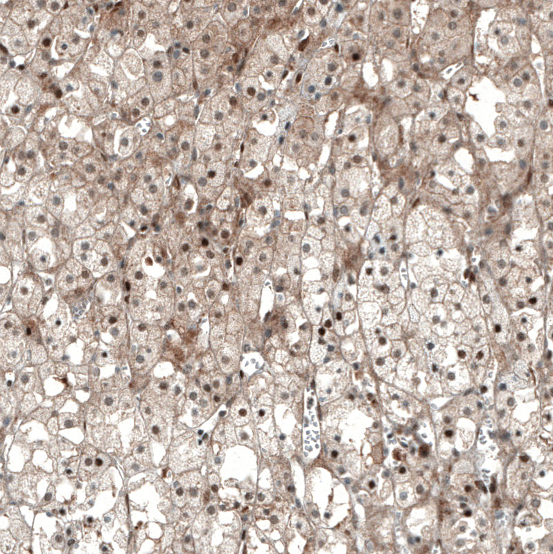 Anti-NR5A1 Antibody