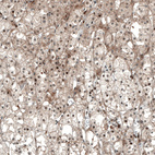 Anti-NR5A1 Antibody