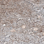 Immunohistochemical staining of human ovary shows moderate positivity in stromal cells.