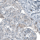 Anti-NR5A1 Antibody