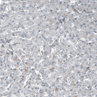 Anti-NR5A1 Antibody