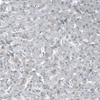 Immunohistochemical staining of human liver shows no positivity in hepatocytes as expected.