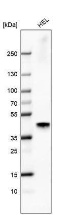 Western blot analysis in human cell line HEL.
