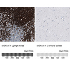 Anti-MS4A1 Antibody