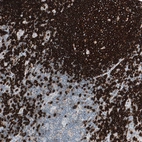 Immunohistochemical staining of human lymph node shows strong membranous positivity in germinal center cells.