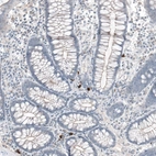 Immunohistochemical staining of human colon shows strong membranous positivity in a small subset of lymphoid cells.