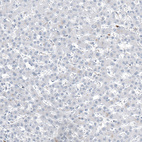 Anti-MS4A1 Antibody