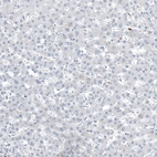 Immunohistochemical staining of human liver shows no positivity in hepatocytes as expected.
