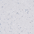 Immunohistochemical staining of human cerebral cortex shows no positivity in neurons as expected.