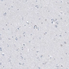 Immunohistochemical staining of human cerebral cortex shows no positivity in neurons as expected.
