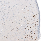 Immunohistochemical staining of rat hypothalamus shows strong nuclear positivity in a subset of neurons.