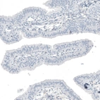 Immunohistochemical staining of human fallopian tube shows no positivity in glandular cells as expected.